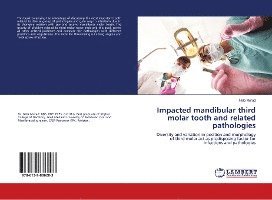 Cover for Murad · Impacted mandibular third molar t (Book)