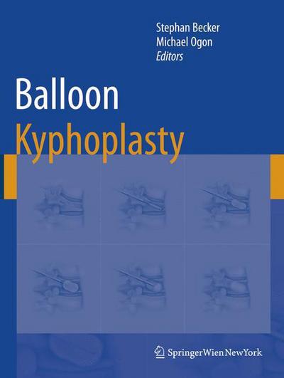 Cover for Stephan Becker · Balloon Kyphoplasty (Hardcover Book) [2008 edition] (2007)