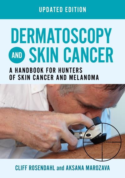 Cover for Cliff Rosendahl · Dermatoscopy and Skin Cancer, updated edition: A handbook for hunters of skin cancer and melanoma (Paperback Book) (2023)