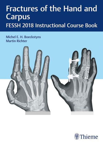 Cover for Mario Sanna · Fractures of the Hand and Carpus: FESSH 2018 Instructional Course Book (Hardcover Book) (2018)