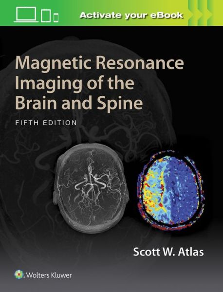 Cover for Scott W. Atlas · Magnetic Resonance Imaging of the Brain and Spine (Hardcover Book) (2016)