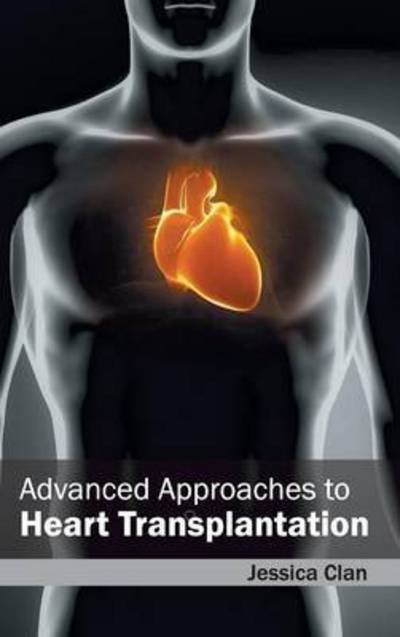 Cover for Jessica Clan · Advanced Approaches to Heart Transplantation (Gebundenes Buch) (2015)