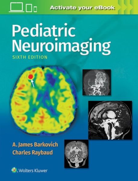 Pediatric Neuroimaging - Barkovich, A. James, MD - Kirjat - Lippincott Williams and Wilkins - 9781496337207 - perjantai 27. huhtikuuta 2018