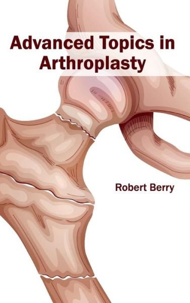 Cover for Robert Berry · Advanced Topics in Arthroplasty (Hardcover Book) (2015)