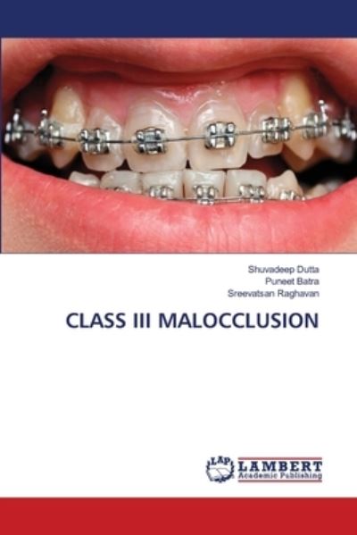 Cover for Dutta · Class III Malocclusion (Book) (2020)