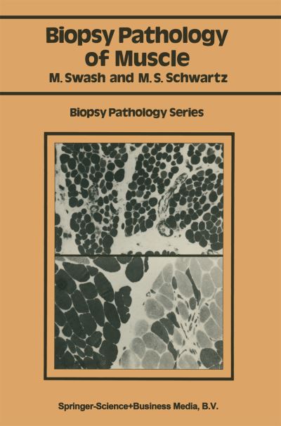 Cover for Michael Swash · Biopsy pathology of muscle - Biopsy Pathology Series (Paperback Book) [1984 edition] (1984)