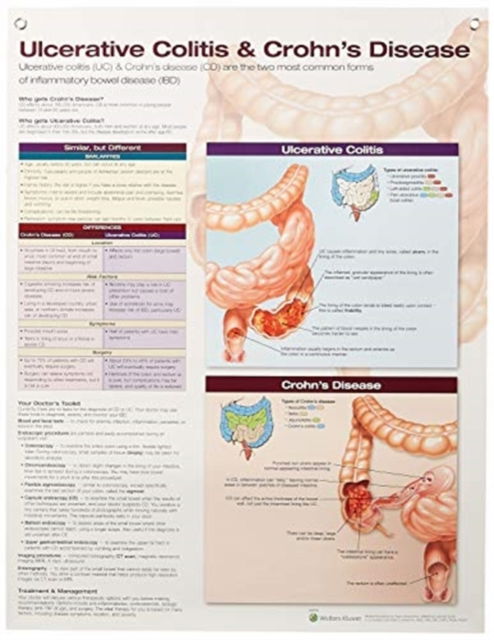 Ulcerative Colitis & Crohn's Disease Anatomical Chart Laminated - Anatomical Chart Company - Gadżety - Lippincott Williams and Wilkins - 9781496388209 - 27 lipca 2018