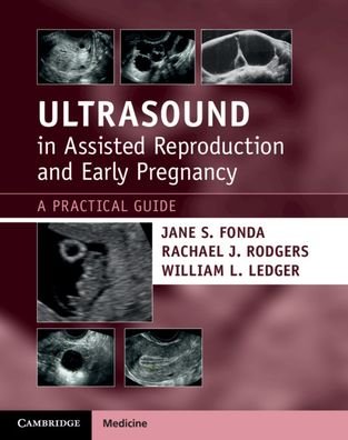 Ultrasound in Assisted Reproduction and Early Pregnancy: A Practical Guide - Fonda, Jane S. (University of Sydney) - Livres - Cambridge University Press - 9781108810210 - 25 mars 2021