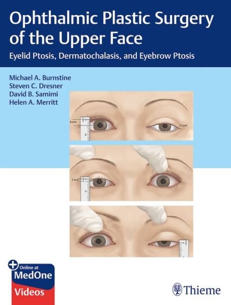 Cover for Michael A. Burnstine · Ophthalmic Plastic Surgery of the Upper Face: Eyelid Ptosis, Dermatochalasis, and Eyebrow Ptosis (Bog) (2019)