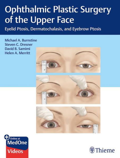 Ophthalmic Plastic Surgery of the Upper Face: Eyelid Ptosis, Dermatochalasis, and Eyebrow Ptosis - Michael A. Burnstine - Bøger - Thieme Medical Publishers Inc - 9781626239210 - 11. december 2019