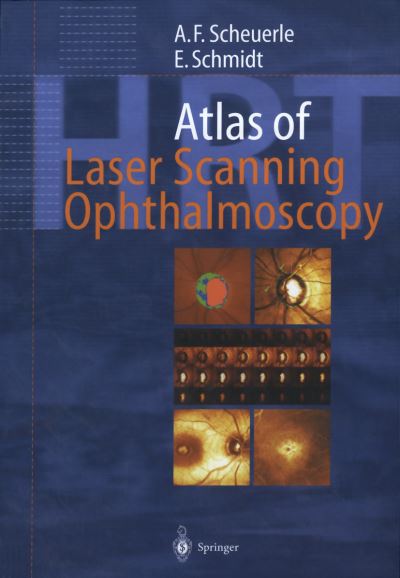 Atlas of Laser Scanning Ophthalmoscopy - Alexander Friedrich Scheuerle - Books - Springer-Verlag Berlin and Heidelberg Gm - 9783642639210 - January 19, 2012