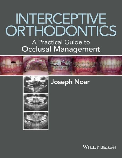 Cover for Joseph Noar · Interceptive Orthodontics: A Practical Guide to Occlusal Management (Pocketbok) (2014)