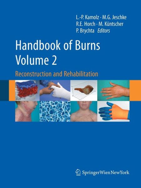 Cover for Handbook of Burns Volume 2: Reconstruction and Rehabilitation (Paperback Book) [Softcover reprint of the original 1st ed. 2012 edition] (2016)
