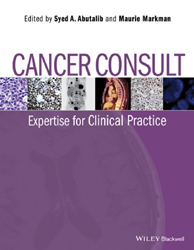 Cover for SA Abutalib · Cancer Consult: Expertise for Clinical Practice (Paperback Book) (2014)