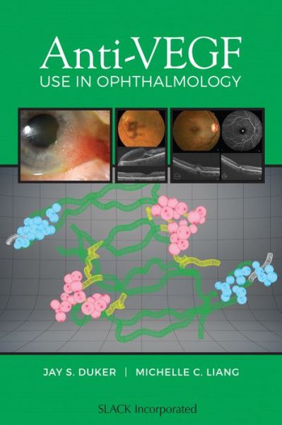 Anti-VEGF Use in Ophthalmology - Jay Duker - Kirjat - SLACK  Incorporated - 9781630913212 - maanantai 15. toukokuuta 2017