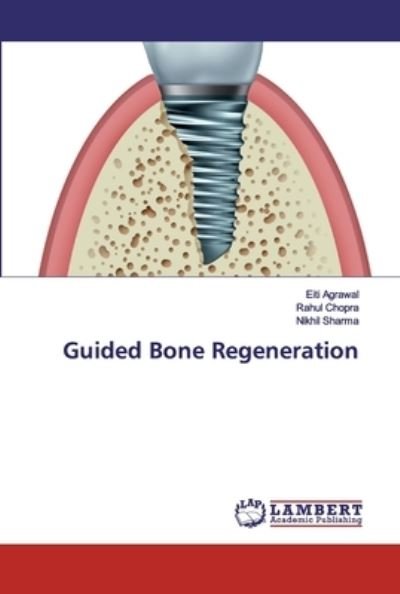 Cover for Agrawal · Guided Bone Regeneration (Bok) (2019)