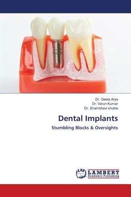 Cover for Arya · Dental Implants (Buch) (2020)