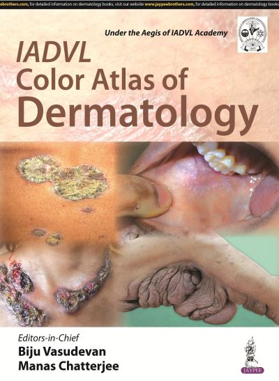 Cover for Biju Vasudevan · IADVL Color Atlas of Dermatology (Hardcover Book) (2016)