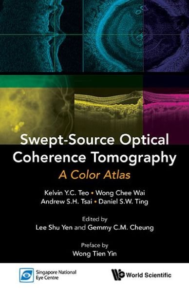 Cover for Teo, Kelvin Yi Chong (S'pore National Eye Centre, S'pore) · Swept-source Optical Coherence Tomography: A Color Atlas (Paperback Bog) (2015)