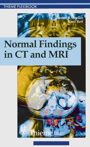 Normal Findings in CT and MRI, A1, Print - Torsten Bert Moeller - Books - Thieme Publishing Group - 9783131165213 - September 30, 1999