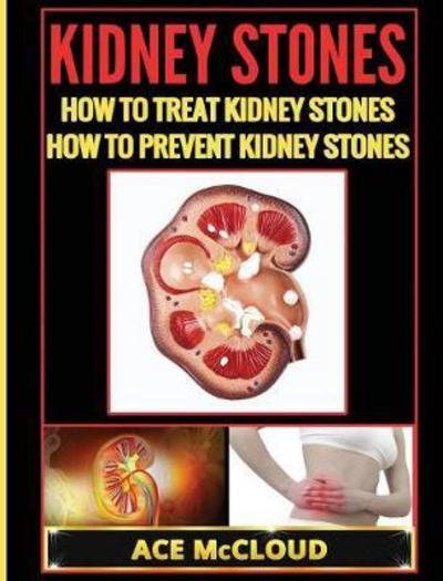Cover for Ace McCloud · Kidney Stones (Innbunden bok) (2017)