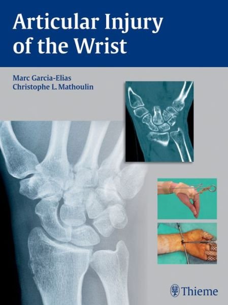 Articular Injury of the Wrist: FESSH 2014 Instructional Course Book - Marc Garcia-Elias - Livros - Thieme Publishing Group - 9783131746214 - 16 de julho de 2014