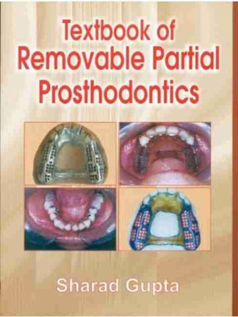 Cover for Sharad Gupta · Textbook of Removable Partial Prosthodontics (Paperback Book) (2009)