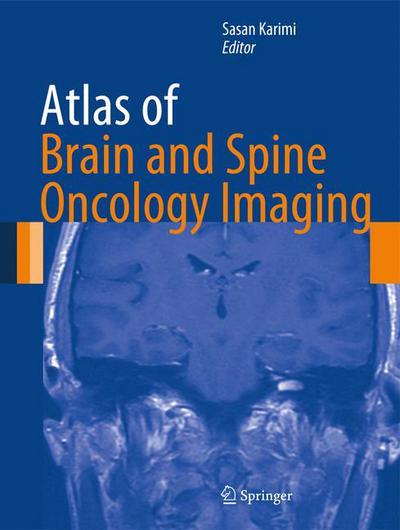 Cover for Sasan Karimi · Atlas of Brain and Spine Oncology Imaging - Atlas of Oncology Imaging (Paperback Book) [2013 edition] (2015)