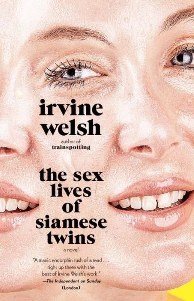 Cover for Irvine Welsh · The Sex Lives of Siamese Twins (Vintage International) (Bog) (2016)