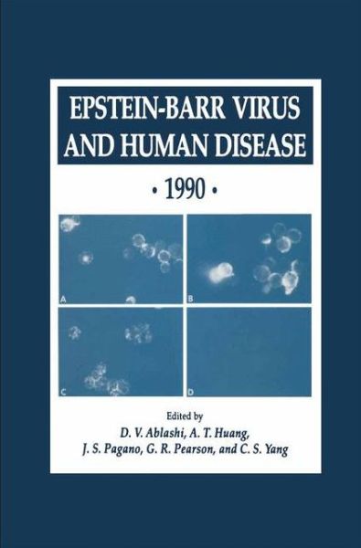 Cover for International Association for Research on Epstein-barr Virus and Associated Diseases · Epstein-Barr Virus and Human Disease * 1990 - Experimental Biology and Medicine (Hardcover Book) [1991 edition] (1991)