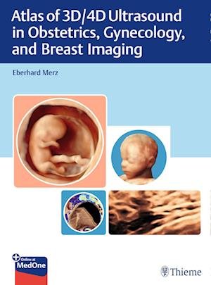 Atlas of 3D/4D Ultrasound in Obstetrics, Gynecology, and Breast Imaging - Eberhard Merz - Libros - Thieme Publishing Group - 9783131764218 - 16 de octubre de 2024