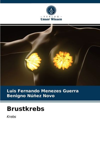 Cover for Luis Fernando Menezes Guerra · Brustkrebs (Paperback Book) (2021)