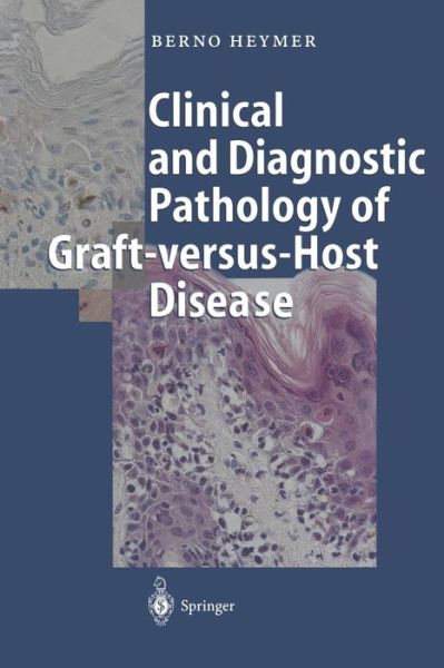 Cover for Berno Heymer · Clinical and Diagnostic Pathology of Graft-versus-Host Disease (Paperback Book) [Softcover reprint of the original 1st ed. 2002 edition] (2011)