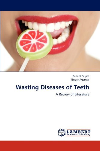 Cover for Nupur Agarwal · Wasting Diseases of Teeth: a Review of Literature (Pocketbok) (2012)