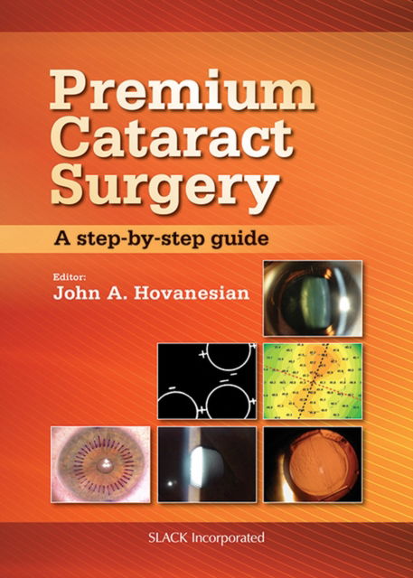 Cover for John Hovanesian · Premium Cataract Surgery: A Step-by-Step Guide (Hardcover Book) (2012)