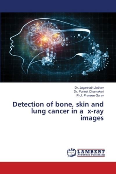 Detection of bone, skin and lung - Jadhav - Boeken -  - 9786202815222 - 23 september 2020
