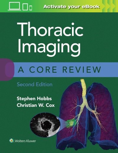 Cover for Stephen Hobbs · Thoracic Imaging: A Core Review - A Core Review (Taschenbuch) (2020)