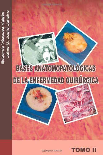 Cover for Eduardo Vázquez V. · Bases Anatomopatológicas De La Enfermedad Quirúrgica: Tomo II (Pocketbok) [Spanish edition] (2011)