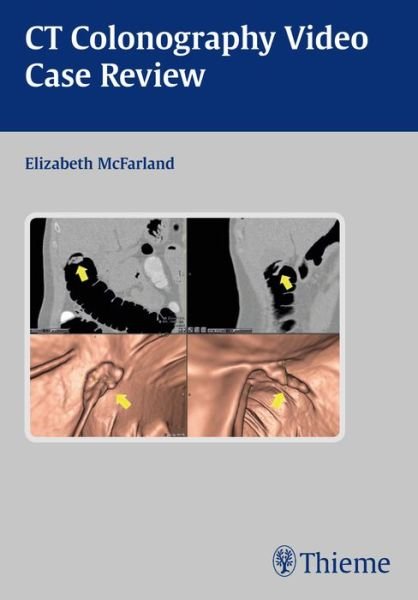 Elizabeth McFarland · Mcfarland:case Review Ct Colon,cd (CD) [1. utgave] (2015)