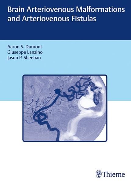 Brain Arteriovenous Malformations and Arteriovenous Fistulas - Aaron S. Dumont - Livres - Thieme Medical Publishers Inc - 9781626233225 - 13 décembre 2017