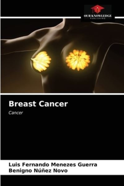 Cover for Luis Fernando Menezes Guerra · Breast Cancer (Paperback Book) (2021)