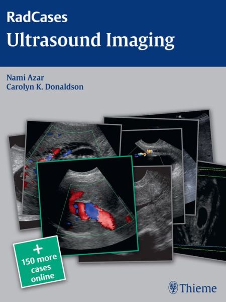 Cover for Nami R. Azar · Radcases Ultrasound Imaging - Radcases Plus Q&amp;a (Paperback Book) [New edition] (2015)