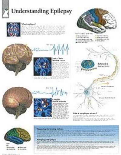 Cover for Scientific Publishing · Understanding Epilepsy Laminated Poster (Poster) (2006)