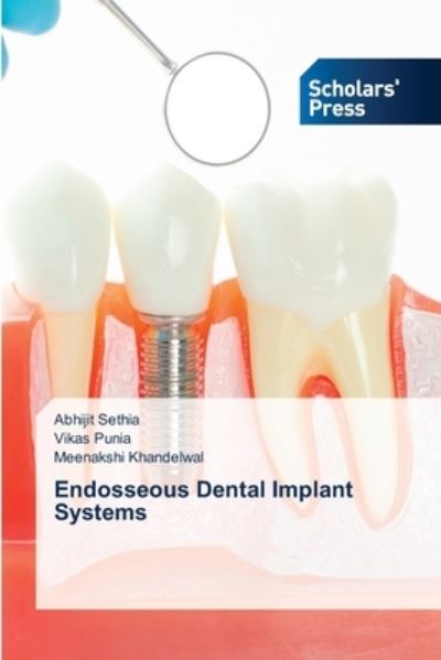 Cover for Abhijit Sethia · Endosseous Dental Implant Systems (Paperback Book) (2021)