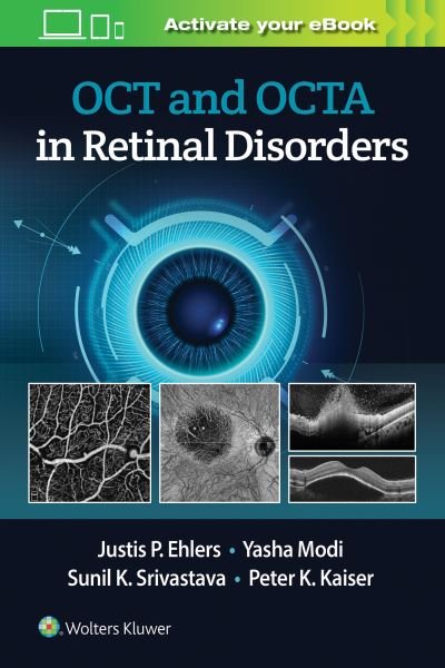 Cover for Justis P. Ehlers · OCT and OCTA in Retinal Disorders (Taschenbuch) (2020)