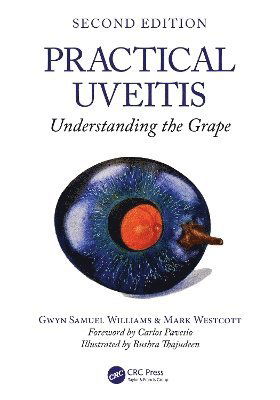 Cover for Gwyn Samuel Williams · Practical Uveitis: Understanding the Grape (Paperback Book) (2025)