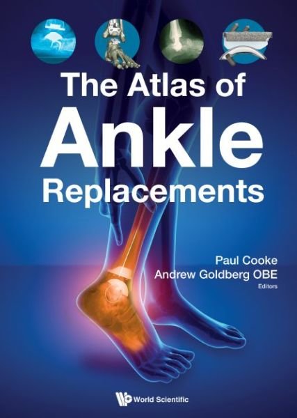 Cover for Paul Cooke · The Atlas Of Ankle Replacements (Hardcover bog) (2020)
