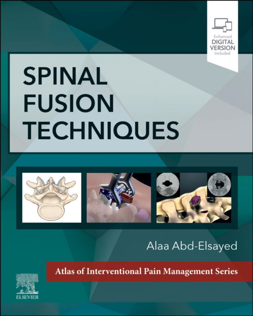 Cover for Abd-Elsayed, Alaa, MD, MBA, MPH, CPE, FASA (University of Wisconsin) · Spinal Fusion Techniques (Hardcover Book) (2023)