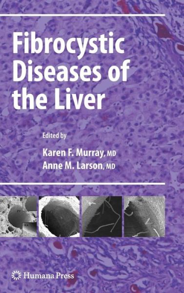 Cover for Karen F Murray · Fibrocystic Diseases of the Liver - Clinical Gastroenterology (Gebundenes Buch) [2010 edition] (2010)