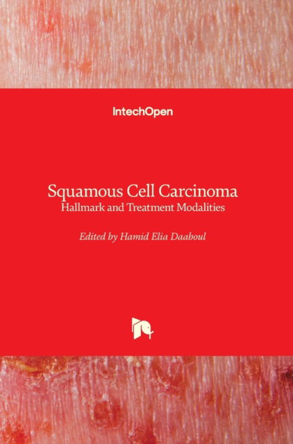 Cover for Hamid Elia Daaboul · Squamous Cell Carcinoma (Hardcover Book) (2020)